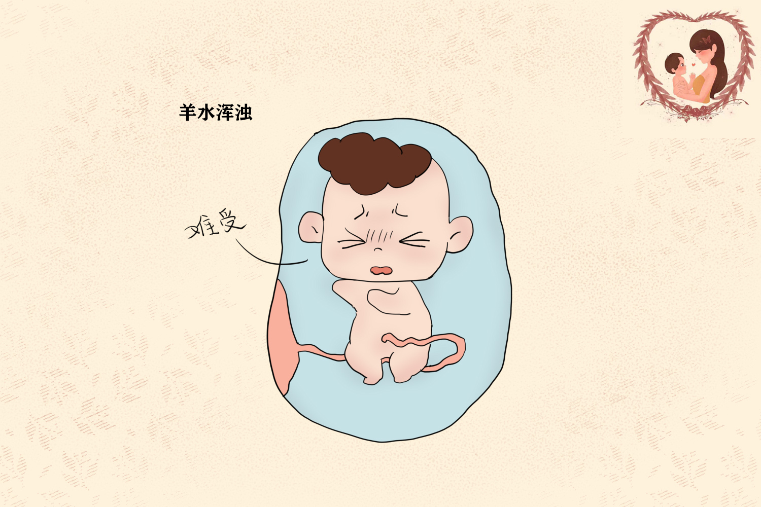 孕期如何让羊水清澈,孕期怎么给宝宝一个好的羊水环境