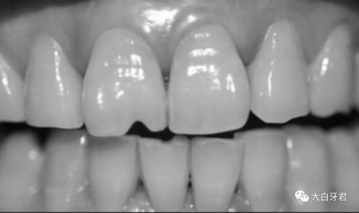 过年嗑瓜子多了好吗,嗑瓜子过年必备