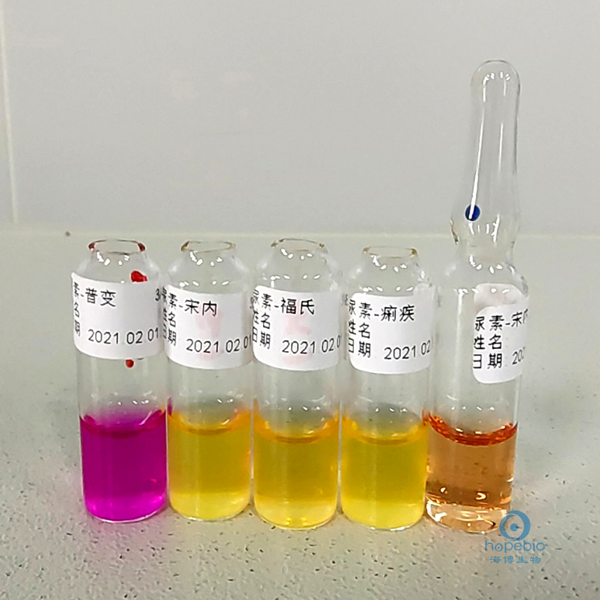 食品中志贺氏菌的检测,志贺氏菌检测标准值是不得检出吗