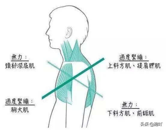 跑后肩部疼痛最快缓解方法,肩颈酸痛是什么原因