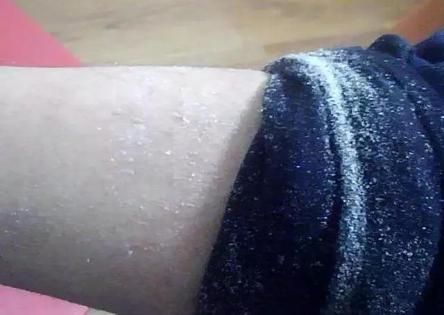 冬天这样护肤,睡觉都是“滑”进去的