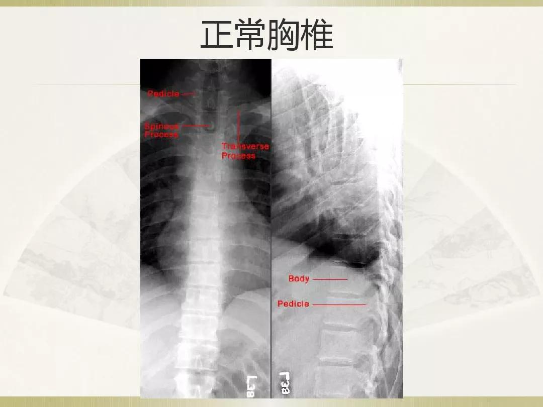 骨科x光片读片技巧,放射科骨科读片教程