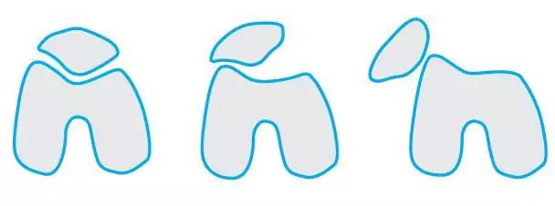 膝关节的22种常见病治疗,膝关节疼痛的相关知识
