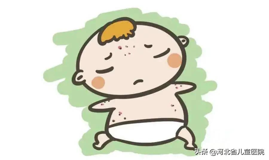 宝宝起疹子中医辨证论治,宝宝出疹子了别着急