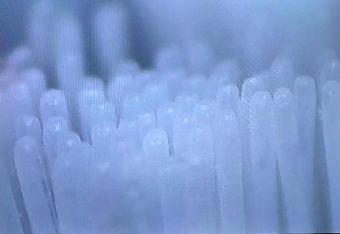 正畸的尴尬时刻，不带上它坚决不出门