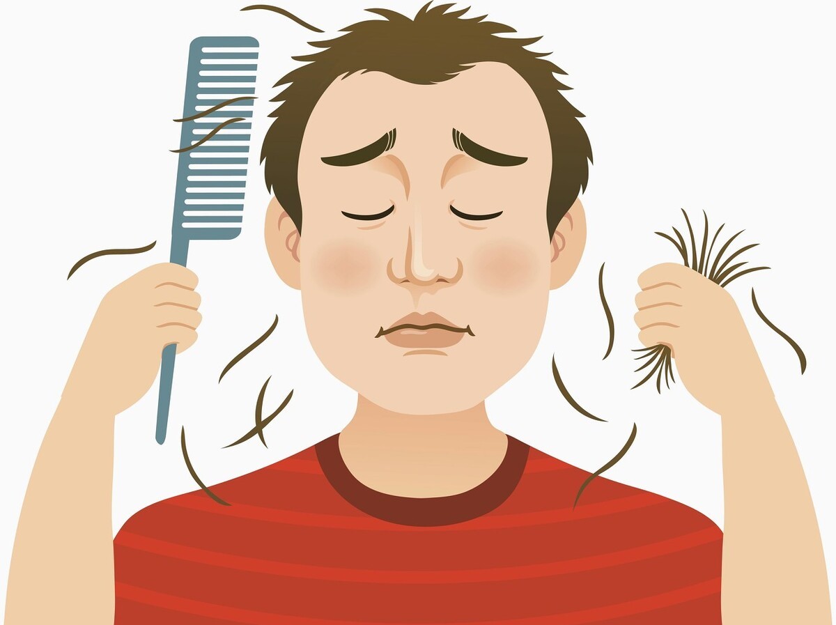 米诺地尔降压副作用,2%的米诺地尔治疗脱发有效吗