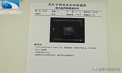 被怀孕？大姐人流手术进行中，却被告知：子宫里面什么都没有