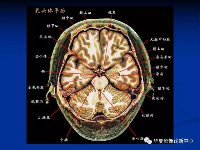 mra头颅解剖学详细讲解视频,常见的头颅mri图像