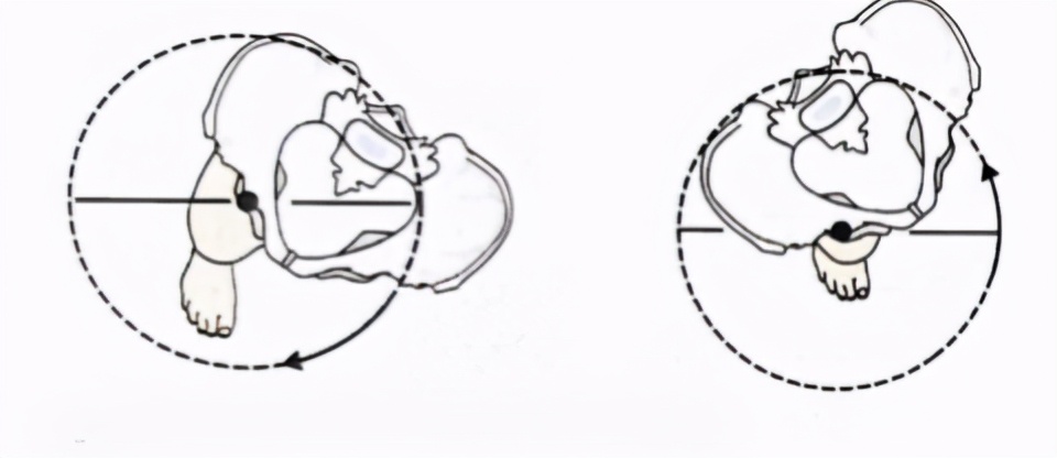 走着走着低头一看,裤子裙子跑偏了?来认领一下是否骨盆旋转