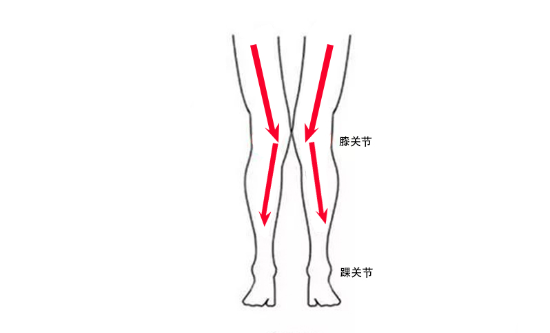 这几种腿型不适合跑步，有你吗？