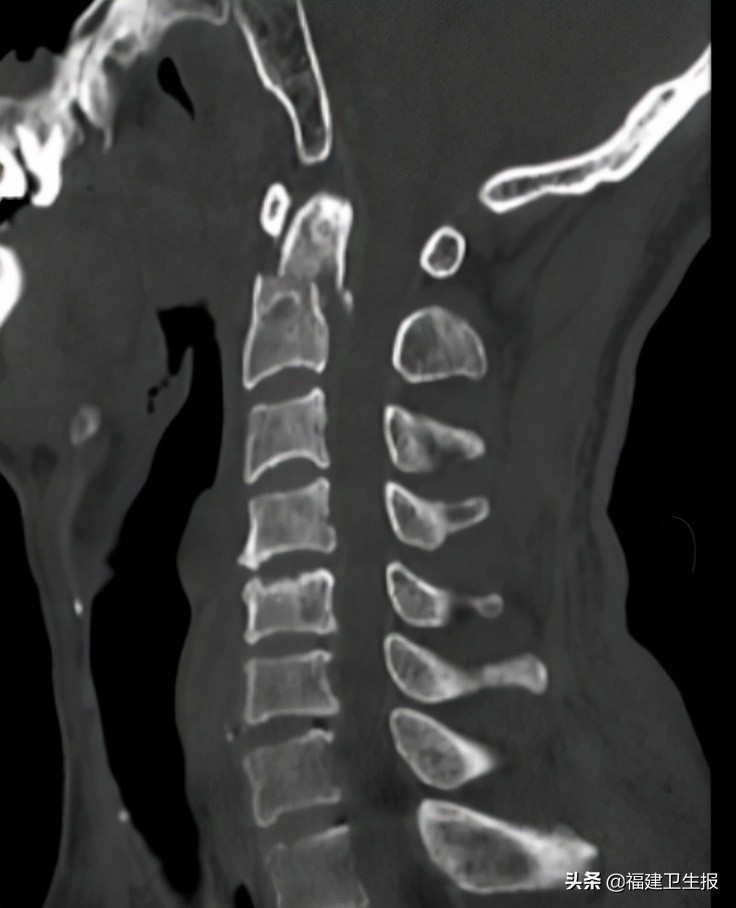 娉夊窞绗竴鍖婚櫌棰堟鎵嬫湳,娉夊窞鍖婚櫌棰堟寰垱