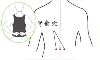 脚后跟鱼鳞状干裂用什么药,小腿后跟干裂起鱼鳞是什么原因