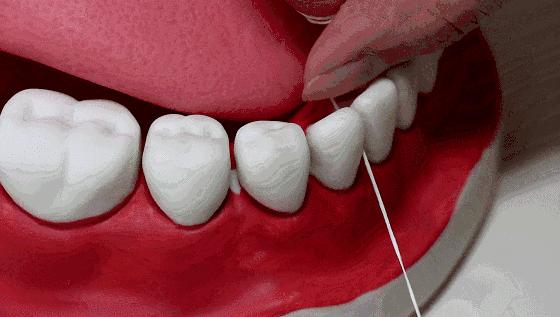 水牙线正确使用方法视频,水牙线冲牙器使用方法