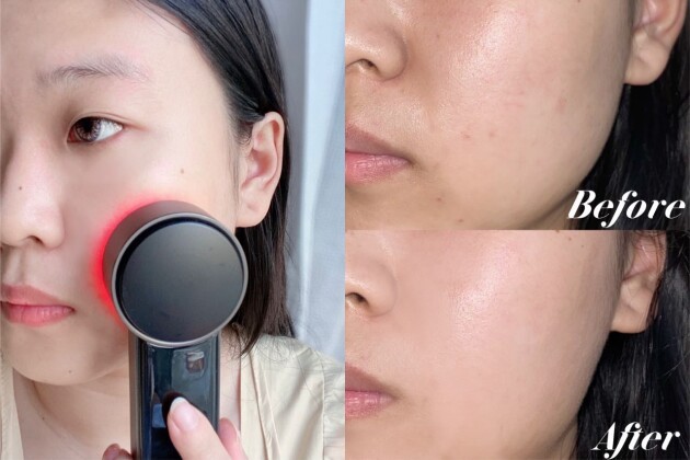 美容仪哪款最好用,美容仪到底哪款好用