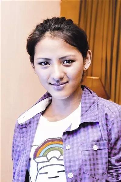 项思醒眼部整容史,项思醒整容了吗