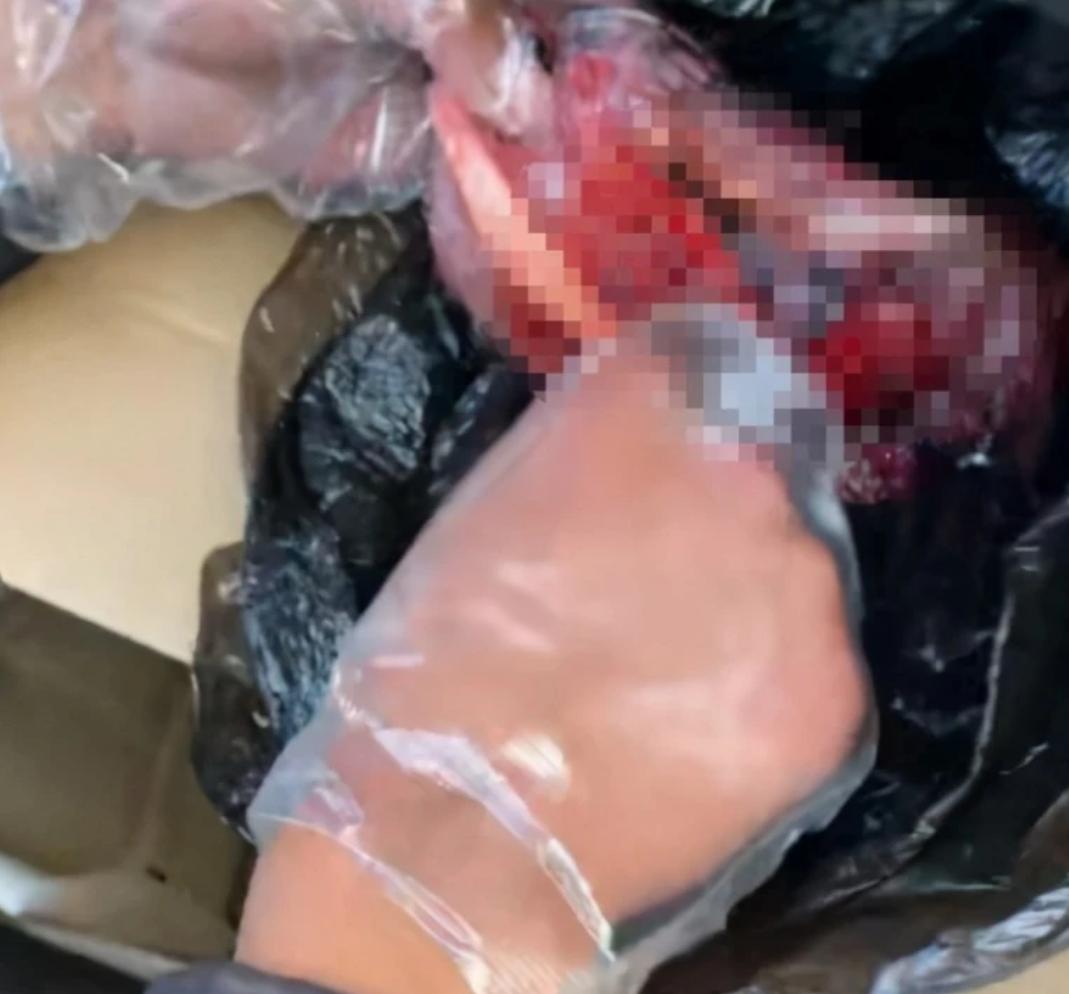 人体胎盘能吃吗有啥作用,胎盘被人吃了会倒霉吗