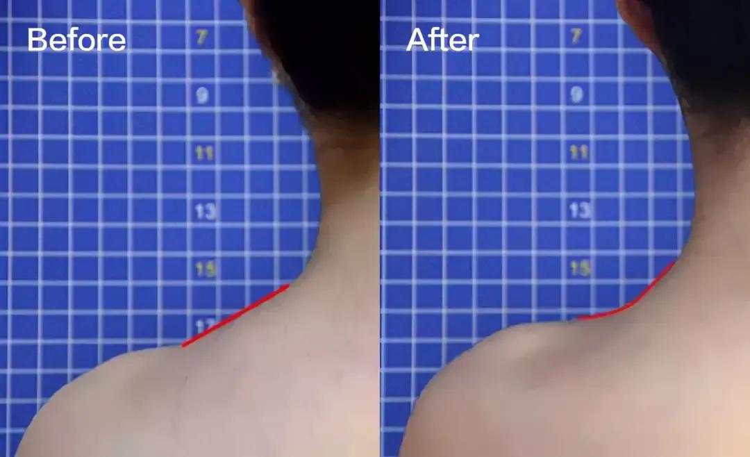 瘦斜方肌直角肩天鹅颈一周训练,女性斜方肌厚怎么治