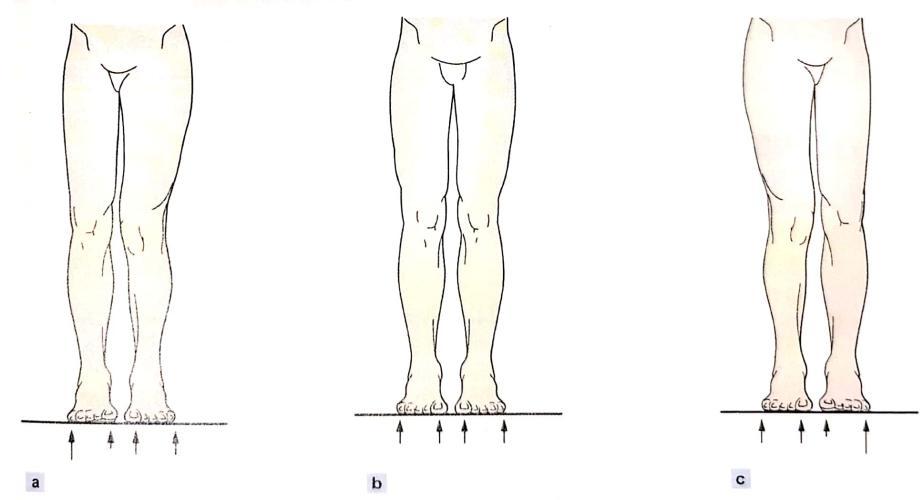 走着走着低头一看,裤子裙子跑偏了?来认领一下是否骨盆旋转