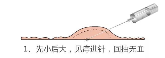 肛肠病诊疗新技术图解,实用肛肠病系列疗法新技术
