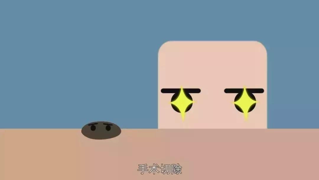 人身上长的黑痣瘊子能变癌症吗,手上长小黑痣会是癌症信号吗