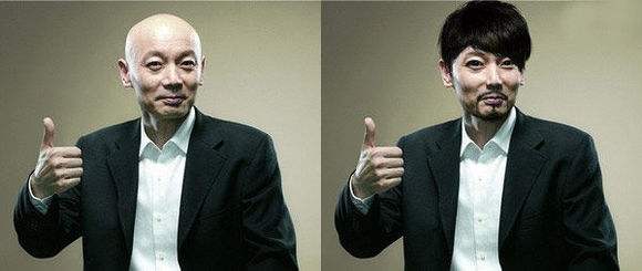 陈奕迅秃顶头发稀疏,陈奕迅同款发际线怎么补救