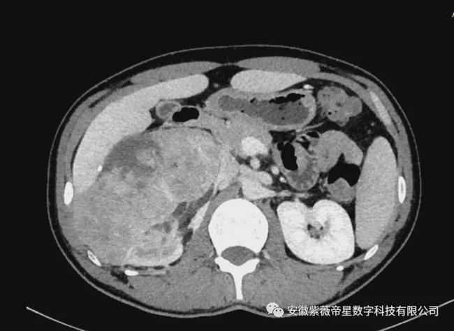 紫薇帝星穴,紫薇帝星医疗科技