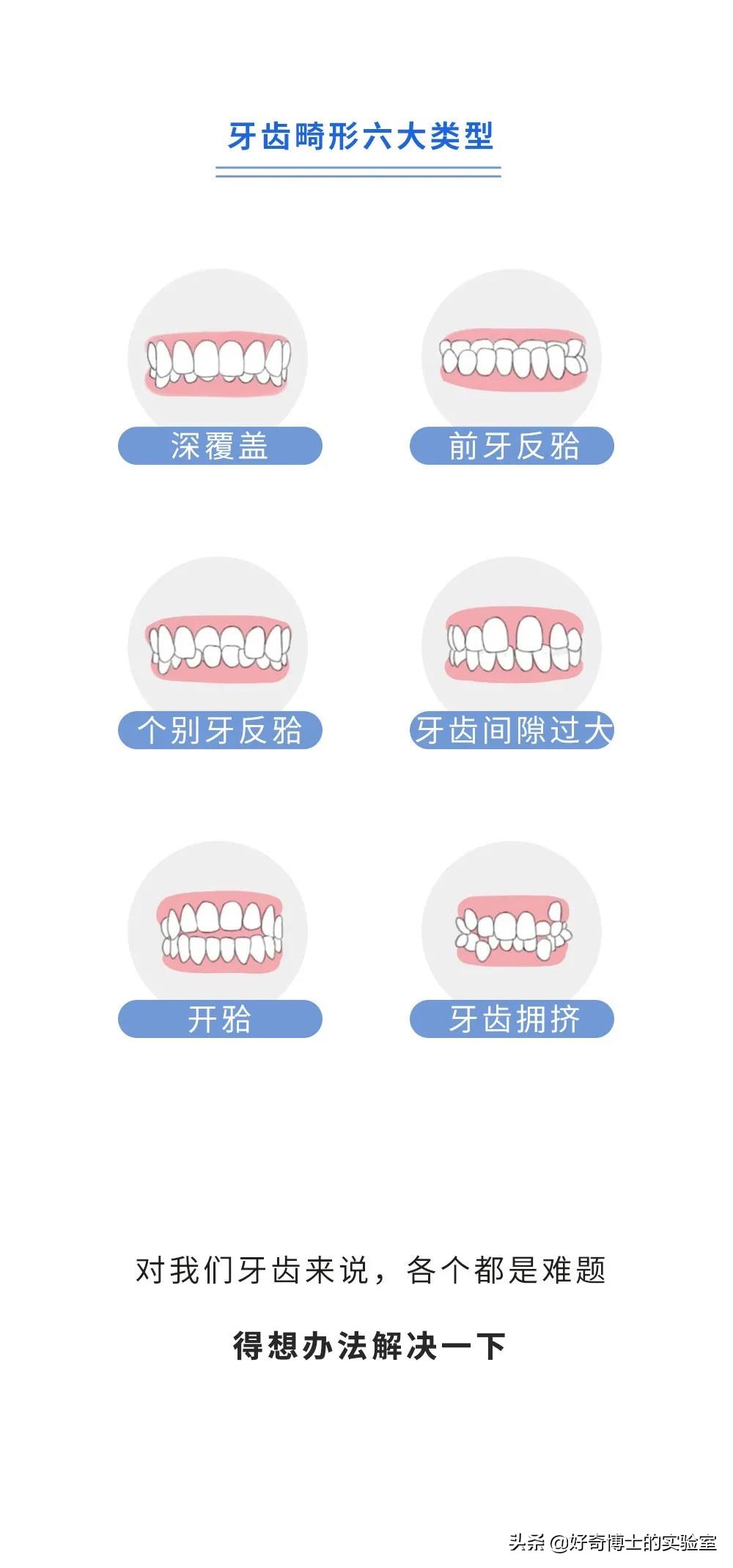 超级不齐的牙齿怎么矫正,下牙齿不齐矫正牙齿的全过程