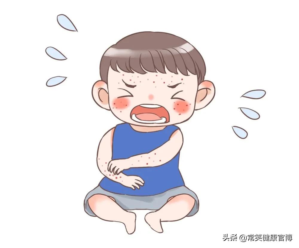 医院开的湿疹膏有激素吗,医生开了湿疹两种药膏要一起涂吗