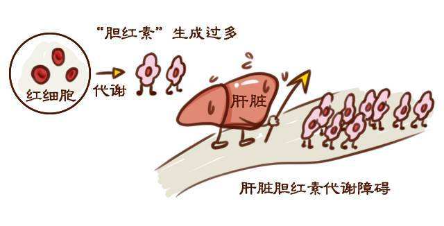 体检发现胆红素高怎么办,体检时查出胆红素偏高有问题吗