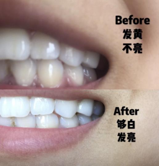 王子文皮肤白吗,王子文美白牙齿的方法