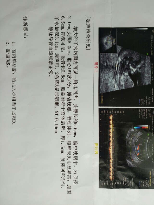 孕期产检全流程一次性说清楚了,孕期检查全流程