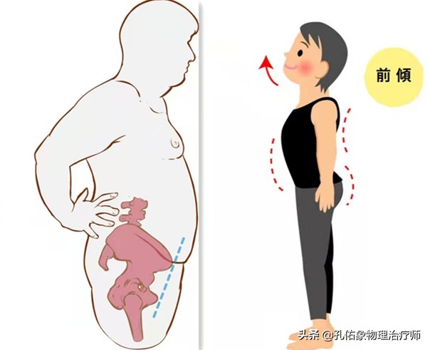 腰酸胀是什么预兆,腰酸疼警惕四种原因