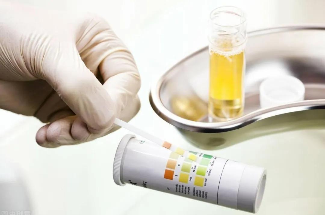 痛风排酸一般需要吃药多久,尿酸高痛风怎么可以快速降酸