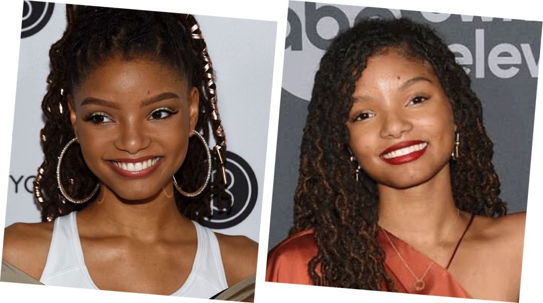 花10万打玻尿酸经验总结,花了将近十万打玻尿酸没有效果