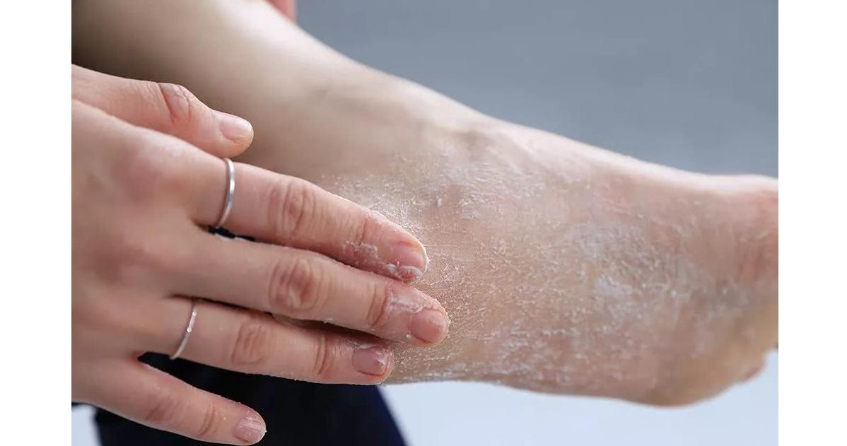 进入夏季之后气候非常炎热,夏季做好脚部卫生及护理很重要