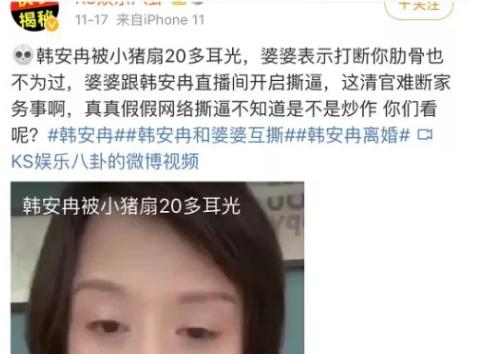 韩安冉整容失败案例,韩安冉整容教科书