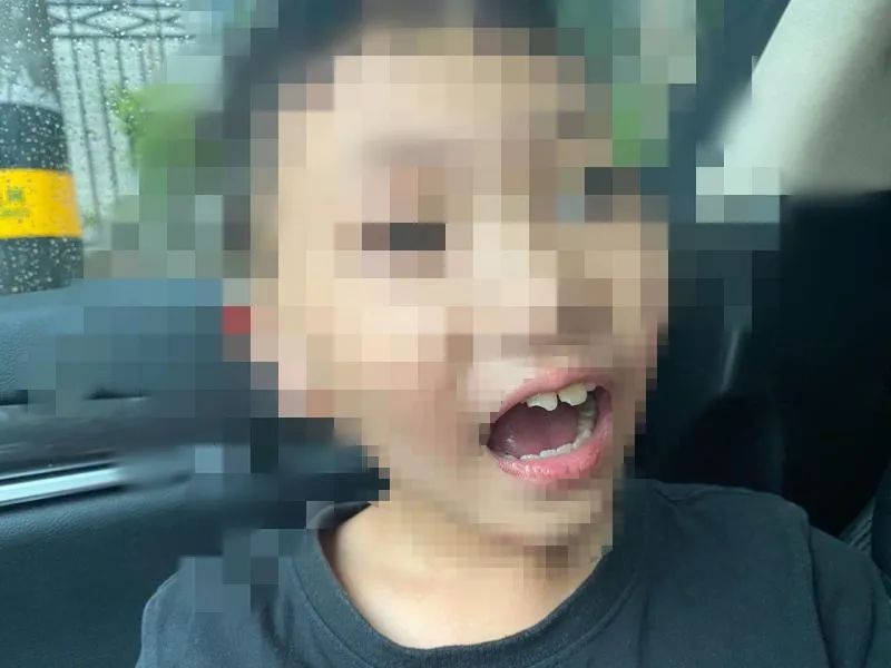 夏令营把牙齿摔了,夏令营孩子受伤谁的责任