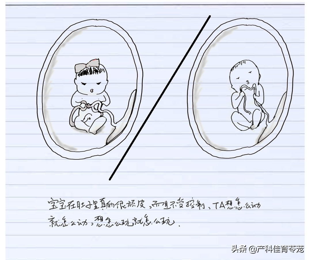 胎心监护脐带受压怎么解决,做胎心监护能看出来脐带问题吗