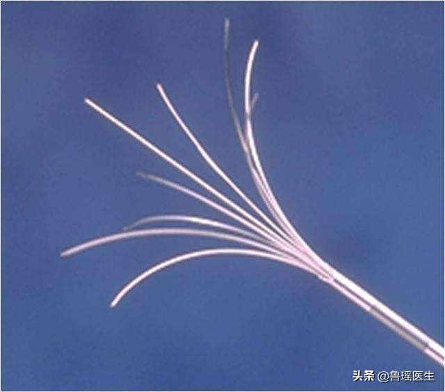 甲状腺癌可以射频消融吗,甲状腺结节是癌能做消融手术吗