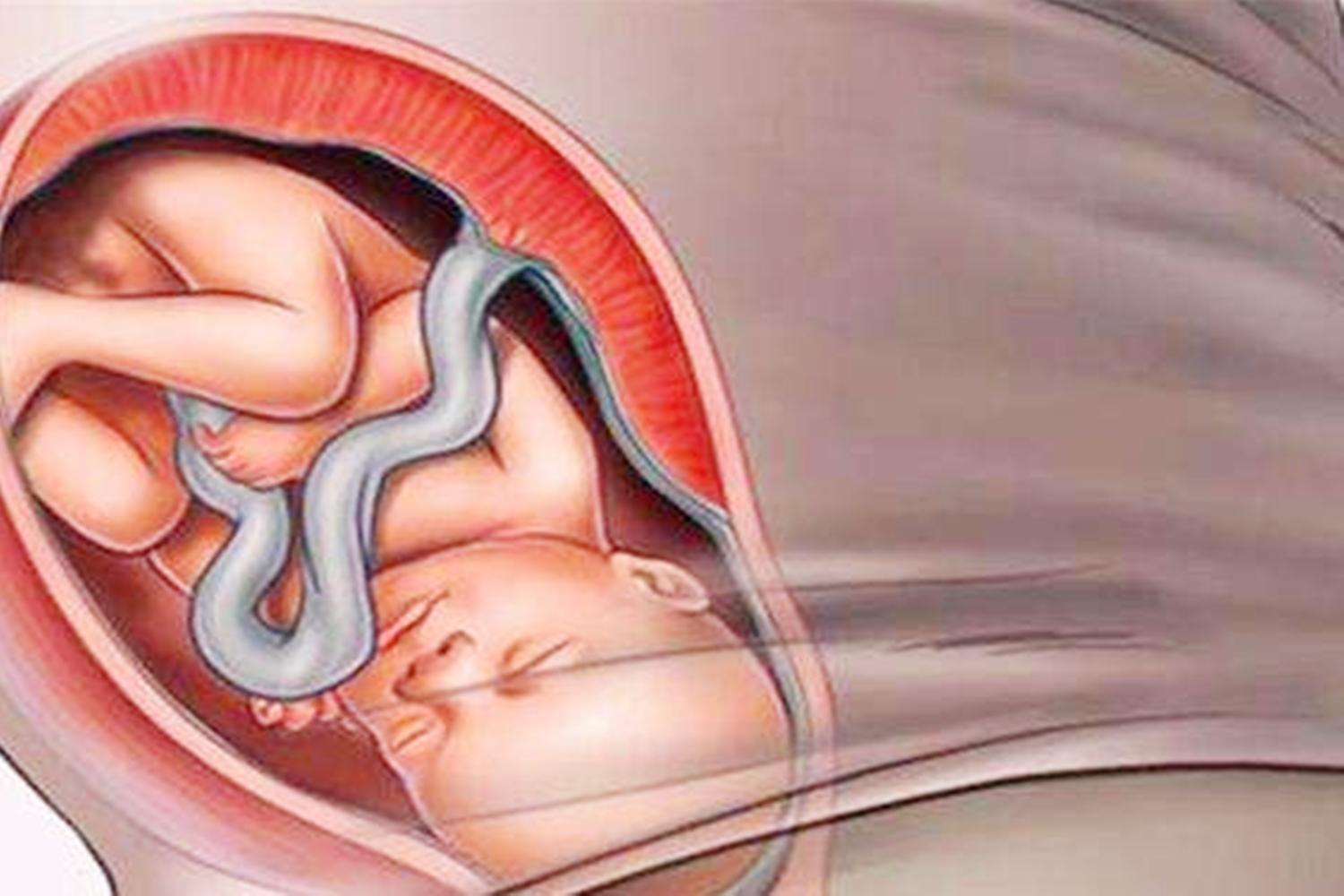 临近产期胎儿入盆，是快要生了吗？胎儿入盆孕妈会有这些感觉