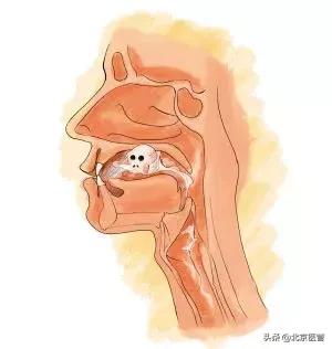 声嘶嘶哑,声音嘶哑是大病前兆