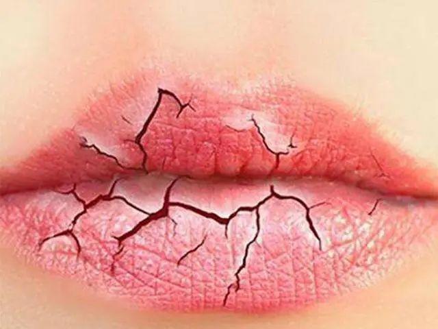 补水滋润唇部干裂,唇保湿滋润补水防干裂