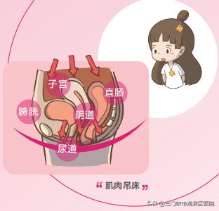 女性盆底功能障碍性疾病,盆底功能障碍性疾病科普