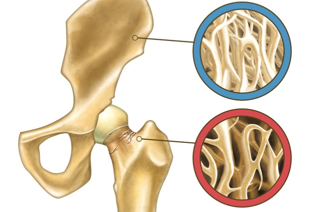 骨折愈合了但是疼可以走路吗,骨折不愈合走路为何不疼