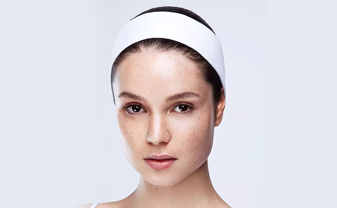 眼睛下面长斑有什么好方法淡斑,眼睛下方有斑块是什么斑怎么消除