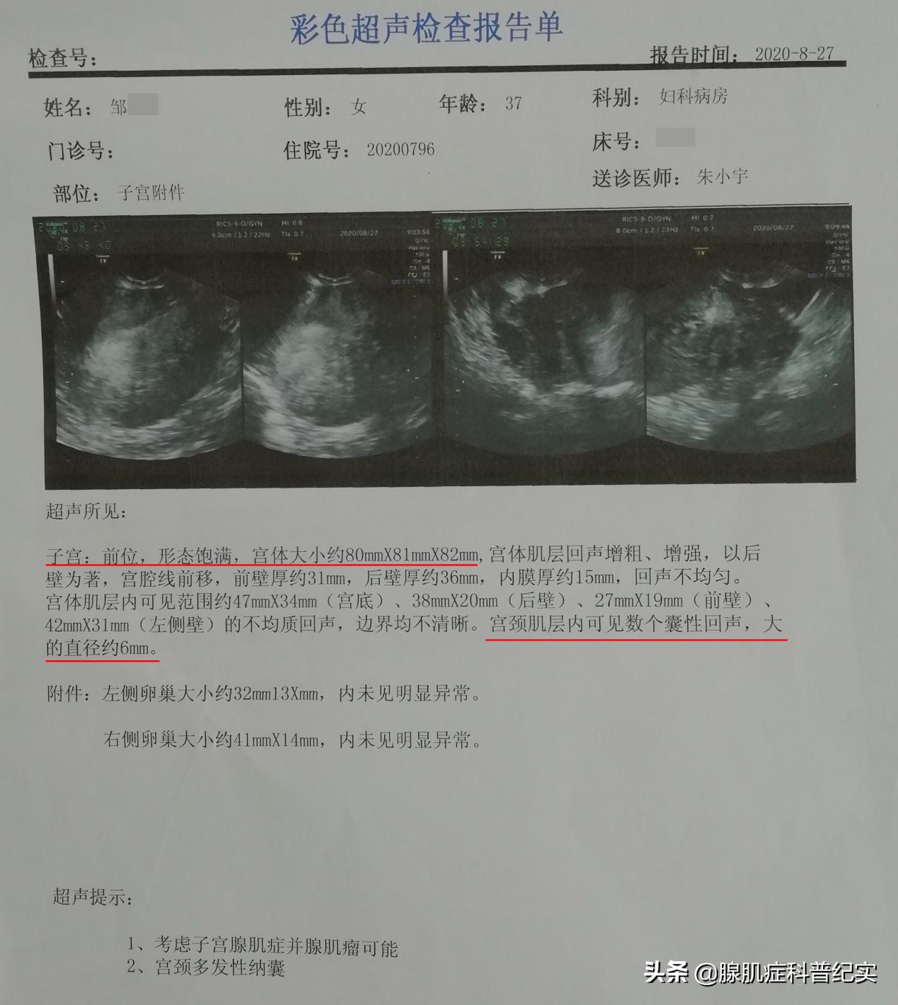 被痛经折磨到生不如死,被痛经折磨