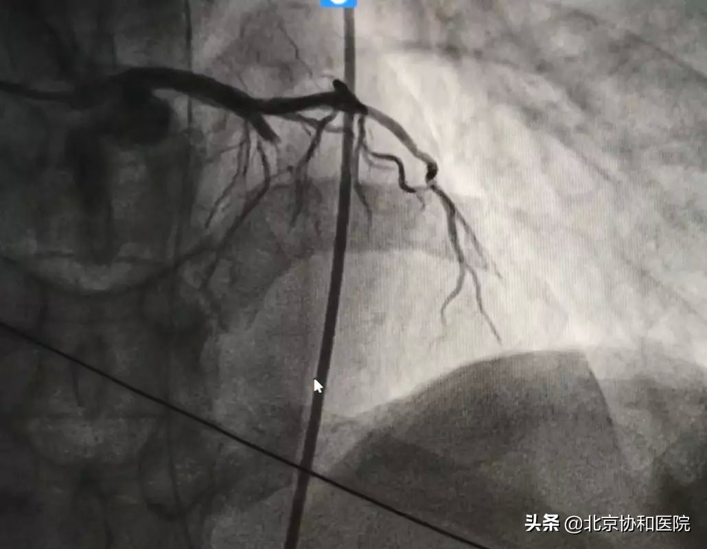 荆州95后护士救人,90后护士路边救人