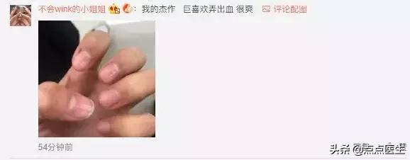 爱拔倒刺是心理疾病么,喜欢拔倒刺属于心理行为问题吗