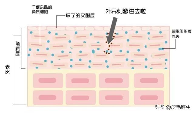 皮肤敏感属于什么皮肤,皮肤敏感的原因和治疗方法