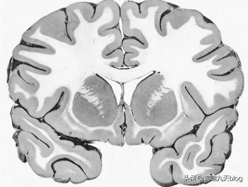 人类大脑如何超越人工智能,人类的出路在于将自身升级为神